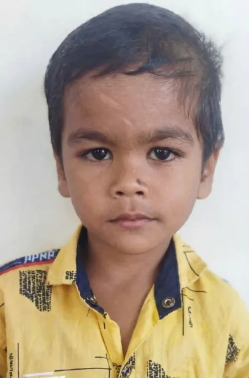 Anurag Nakum
